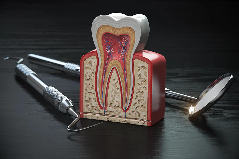 Root canal Treatment 1