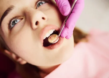 Periodontology at Sky Dental Clinic